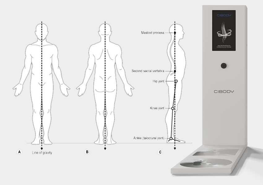 Klinik postür değerlendirme yöntemlerini, fizyoterapi ortamında manuel ve dijital analiz süreçleriyle gösteren görsel